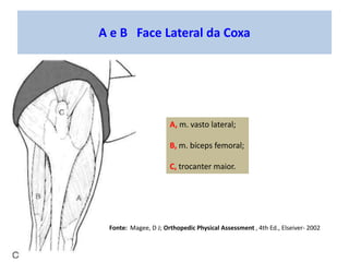 A e B Face posterior do Quadril e da Pelve
A, crista ilíaca;
B, espinha ilíaca
póstero-superior;
C, articulação
sacroilíac...
