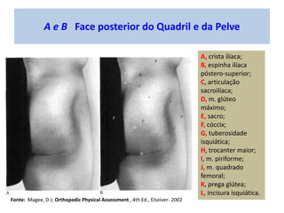 C Face posterior do Quadril e da Pelve
A, crista ilíaca;
B, espinha ilíaca
póstero-superior;
C, articulação
sacroilíaca;
D...