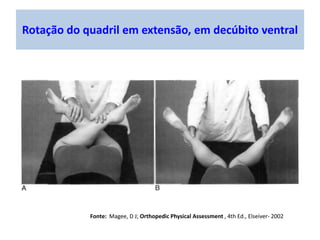 Rotação lateral do quadril em flexão
Fonte: Magee, D J; Orthopedic Physical Assessment , 4th Ed., Elseiver- 2002
 