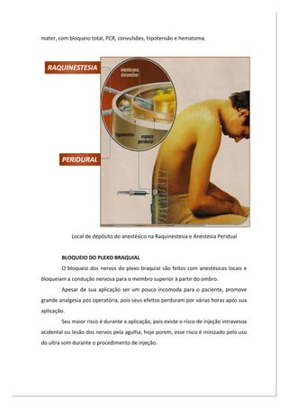 mater, com bloqueio total, PCR, convulsões, hipotensão e hematoma.
Local de depósito do anestésico na Raquinestesia e Anestesia Peridual
BLOQUEIO DO PLEXO BRAQUIAL
O bloqueio dos nervos do plexo braquial são feitos com anestésicos locais e
bloqueiam a condução nervosa para o membro superior à partir do ombro.
Apesar de sua aplicação ser um pouco incomoda para o paciente, promove
grande analgesia pós operatória, pois seus efeitos perduram por várias horas após sua
aplicação.
Seu maior risco é durante a aplicação, pois existe o risco de injeção intravesoa
acidental ou lesão dos nervos pela agulha, hoje porem, esse risco é minizado pelo uso
do ultra som durante o procedimento de injeção.
 