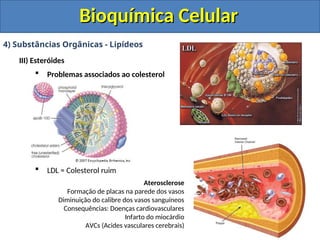 Bioquímica Celular
Bioquímica Celular
4) Substâncias Orgânicas - Lipídeos
III) Esteróides
 Problemas associados ao colesterol
 LDL = Colesterol ruim
Aterosclerose
Formação de placas na parede dos vasos
Diminuição do calibre dos vasos sanguíneos
Consequências: Doenças cardiovasculares
Infarto do miocárdio
AVCs (Acides vasculares cerebrais)
 