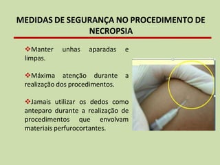 MEDIDAS DE SEGURANÇA NO PROCEDIMENTO DE
NECROPSIA
❖Manter unhas aparadas e
limpas.
❖Máxima atenção durante a
realização dos procedimentos.
❖Jamais utilizar os dedos como
anteparo durante a realização de
procedimentos que envolvam
materiais perfurocortantes.
 