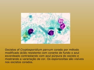 Oocistos of Cryptosporidium parvum corado por método 
modificado ácido resistente com corante de fundo o azul 
esverdeado contrastando com azul púrpura do oocisto e 
mostrando a varariação de cor. Os esporozoítas são visíveis 
nos oocistos corados. 
 