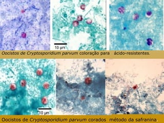 Oocistos de Cryptosporidium parvum coloração para ácido-resistentes. 
Oocistos de Cryptosporidium parvum corados método da safranina. 
 