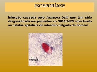 IISSOOSSPPOORRÍÍAASSEE 
Infecção causada pelo Isospora belli que tem sido 
diagnosticada em pacientes co SIDA/AIDS infectando 
as células epiteliais do intestino delgado do homem 
 