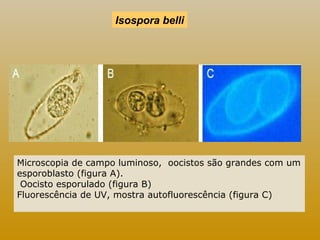 Isospora belli 
Microscopia de campo luminoso, oocistos são grandes com um 
esporoblasto (figura A). 
Oocisto esporulado (figura B) 
Fluorescência de UV, mostra autofluorescência (figura C) 
 