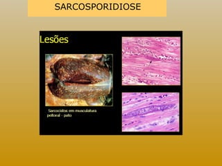 SARCOSPORIDIOSE 
 