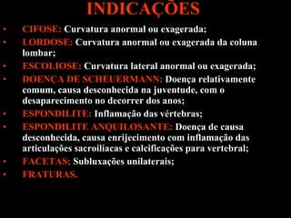 INDICAÇÕES   CIFOSE:  Curvatura anormal ou exagerada; LORDOSE:  Curvatura anormal ou exagerada da coluna lombar; ESCOLIOSE:  Curvatura lateral anormal ou exagerada;  DOENÇA DE SCHEUERMANN:  Doença relativamente comum, causa desconhecida na juventude, com o desaparecimento no decorrer dos anos; ESPONDILITE:  Inflamação das vértebras; ESPONDILITE ANQUILOSANTE:  Doença de causa desconhecida, causa enrijecimento com inflamação das articulações sacroilíacas e calcificações para vertebral;  FACETAS;  Subluxações unilaterais; FRATURAS. 