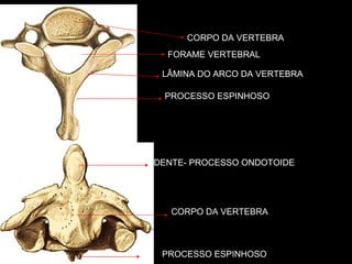 7º VERTEBRA  CERVICAL 2º VERTEBRA CERVICAL PROCESSO ESPINHOSO FORAME VERTEBRAL LÂMINA DO ARCO DA VERTEBRA CORPO DA VERTEBRA PROCESSO ESPINHOSO CORPO DA VERTEBRA DENTE- PROCESSO ONDOTOIDE PROCESSO TRANSVERSO 