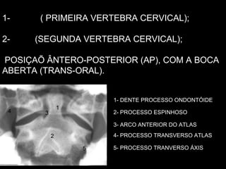 1- ATLAS  ( PRIMEIRA VERTEBRA CERVICAL); 2-  ÁXIS  (SEGUNDA VERTEBRA CERVICAL); POSIÇAÕ ÂNTERO-POSTERIOR (AP), COM A BOCA ABERTA (TRANS-ORAL). 1 1- DENTE PROCESSO ONDONTÓIDE 2 2- PROCESSO ESPINHOSO 3 3- ARCO ANTERIOR DO ATLAS 4 4- PROCESSO TRANSVERSO ATLAS 5 5- PROCESSO TRANVERSO ÁXIS 