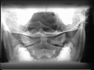 ATLAS E ÁXIS AP (TRANS - ORAL) 