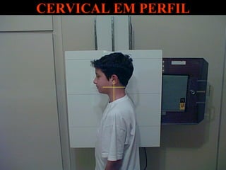 CERVICAL EM PERFIL 