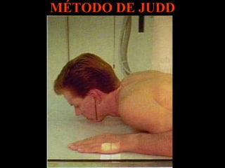 MÉTODO DE JUDD 