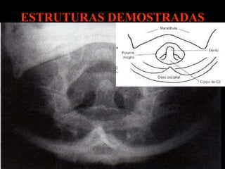 ESTRUTURAS DEMOSTRADAS 