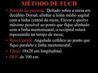 MÉTODO DE FUCH Posição do paciente:  Deitado sobre a mesa em decúbito Dorsal, alinhar a linha médio sagital com a linha central da mesa; Elevar o queixo máximo possível ao ponto que fique alinhado com a linha mentomeatal, o occipital estará repousando no tampo da mesa; Raio Central:  Angulado cefálico ao ponto que fique paralelo a linha mentomeatal; Filme:  18x28 em longitudinal. DFF:   de 100 cm.   