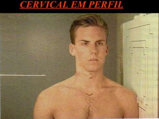 CERVICAL EM PERFIL 
