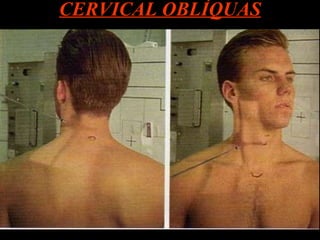 CERVICAL OBLÍQUAS 