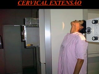 CERVICAL EXTENSÃO 