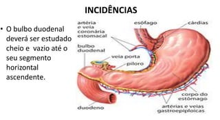 INCIDÊNCIAS
• O bulbo duodenal
deverá ser estudado
cheio e vazio até o
seu segmento
horizontal
ascendente.
 