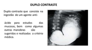 DUPLO CONTRASTE
Duplo contraste que consiste na
ingestão de um agente anti-
ácido para estudos das
mucosas, bem como algumas
outras manobras são
sugeridas e realizadas a critério
médico.
 
