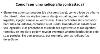 Como fazer uma radiografia contrastada?
• Elementos químicos pesados (de alta densidade), como o iodo ou o bário
são introduzidos nos órgãos que se deseja visualizar, por meio de
ingestão, injeção venosa ou outras vias. Esses contrastes são chamados
baritados ou iodados, conforme o sal usado. Quando essas substâncias
são ingeridas, elas preenchem as cavidades digestivas e as radiografias
tomadas de imediato podem revelar eventuais anormalidades delas e de
suas paredes. É o que acontece, por exemplo, com as radiografias
do esôfago.
 