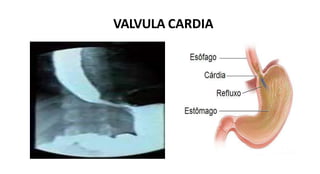 VALVULA CARDIA
 