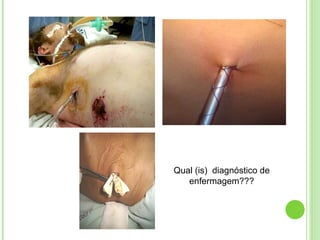 Qual (is) diagnóstico de
enfermagem???
 