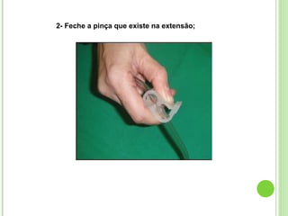 2- Feche a pinça que existe na extensão;
 