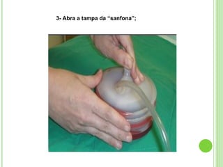 3- Abra a tampa da “sanfona”;
 