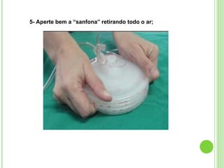 5- Aperte bem a “sanfona” retirando todo o ar;
 