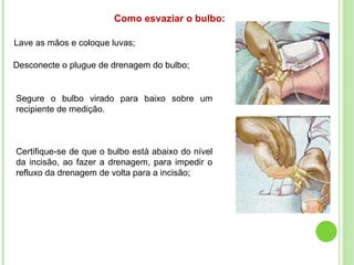 Como esvaziar o bulbo:
Lave as mãos e coloque luvas;
Desconecte o plugue de drenagem do bulbo;
Segure o bulbo virado para baixo sobre um
recipiente de medição.
Certifique-se de que o bulbo está abaixo do nível
da incisão, ao fazer a drenagem, para impedir o
refluxo da drenagem de volta para a incisão;
 