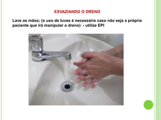 ESVAZIANDO O DRENO
Lave as mãos; (o uso de luvas é necessário caso não seja a própria
paciente que irá manipular o dreno) - utilize EPI
 
