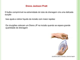 O bulbo comprimível na extremidade do tubo de drenagem cria uma delicada
sucção
Dreno Jackson Pratt
Isso ajuda a retirar líquido da incisão com maior rapidez
Os cirurgiões colocam um Dreno JP na incisão quando se espera grande
quantidade de drenagem
 