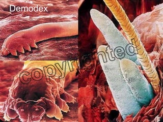 Demodex 