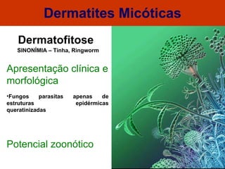 Dermatites Micóticas Dermatofitose Apresentação clínica e morfológica Fungos parasitas apenas de estruturas epidérmicas queratinizadas Potencial zoonótico SINONÍMIA – Tinha, Ringworm 