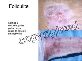 Foliculite Alergias e endocrinopatias podem ser a causa de base de uma foliculite! 