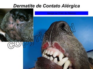 Dermatite de Contato Alérgica Alergia ao Prato de Plástico 