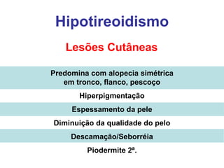 Hipotireoidismo Lesões Cutâneas Predomina com alopecia simétrica em tronco, flanco, pescoço Hiperpigmentação Espessamento da pele Diminuição da qualidade do pelo Descamação/Seborréia Piodermite 2ª. 