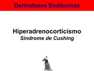 Dermatoses Endócrinas Hiperadrenocorticismo Síndrome de Cushing 