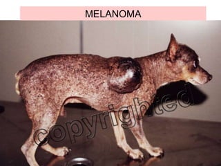 MELANOMA 