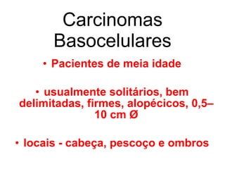 Carcinomas Basocelulares Pacientes de meia idade usualmente solitários, bem delimitadas, firmes, alopécicos, 0,5–10 cm Ø locais - cabeça, pescoço e ombros 