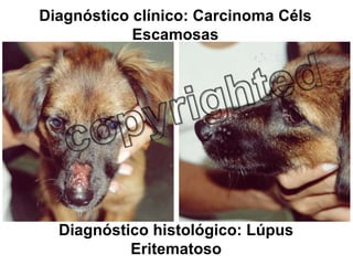 Diagnóstico histológico: Lúpus Eritematoso Diagnóstico clínico: Carcinoma Céls Escamosas 