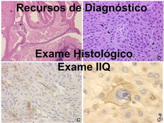 Recursos de Diagnóstico Exame Histológico Exame IIQ 