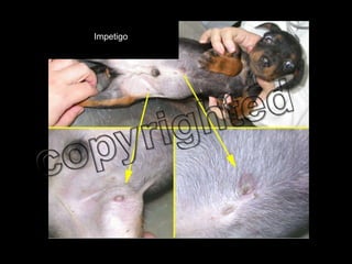 Impetigo 
