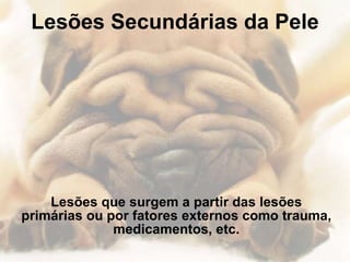 Lesões Secundárias da Pele Lesões que surgem a partir das lesões primárias ou por fatores externos como trauma, medicamentos, etc. 