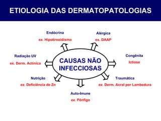 ETIOLOGIA DAS DERMATOPATOLOGIAS Radiação UV ex. Derm. Actínica Alérgica ex. DAAP Traumática ex.  Derm. Acral por Lambedura Auto-Imune ex.  Pênfigo Congênita Ictiose Nutrição ex.  Deficiência de Zn Endócrina ex.   Hipotireoidismo CAUSAS NÃO INFECCIOSAS 
