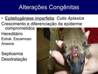 Alterações Congênitas Epiteliogênese imperfeita :  Cutis Aplasica Crescimento e diferenciação da epiderme comprometidos Hereditário Extrat. Escamoso Anexos Septicemia Desidratação 