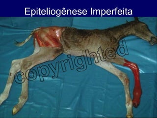 Epiteliogênese Imperfeita 