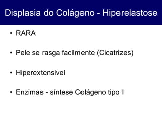 Displasia do Colágeno - Hiperelastose RARA Pele se rasga facilmente (Cicatrizes) Hiperextensivel Enzimas - síntese Colágeno tipo I 