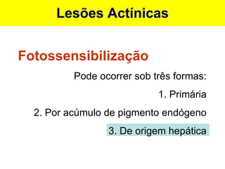 Lesões Actínicas Fotossensibilização Pode ocorrer sob três formas: 1. Primária 2. Por acúmulo de pigmento endógeno 3. De origem hepática 